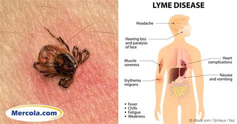 When it does rain, it comes in short bursts. Lyme Disease - The New All-round Challenge - Dr. Manja Podratz