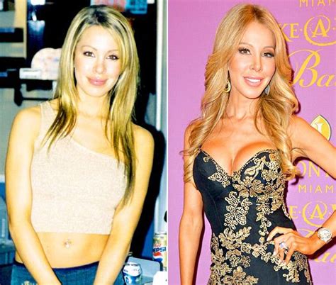 Real Housewives Plastic Surgery Before And After Photos Artofit