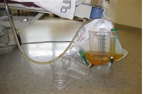 Prevention Of Catheter Associated Urinary Tract Infections Through Evidence Based Management Of