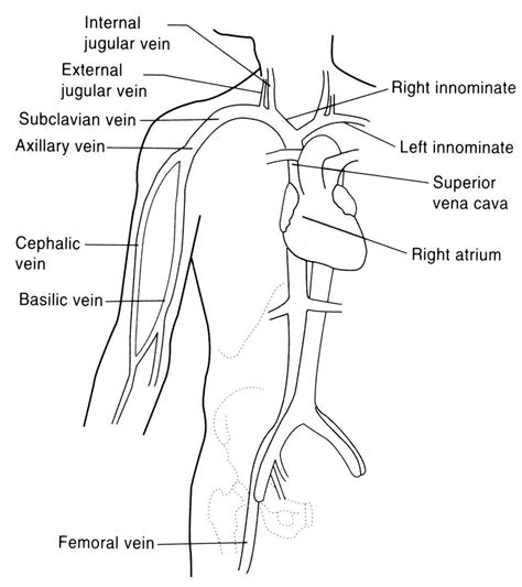 361 The Main Veins Used For Central Venous Catheter Placement