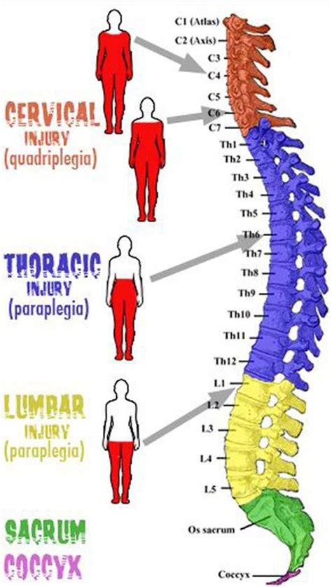 Injuries To The Spine And What They Cause Nursing School Tips