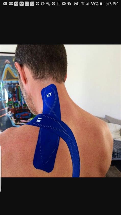 Kinesio Taping Method For Cervical Dystonia Tendinitis Anatomi Ve Spor