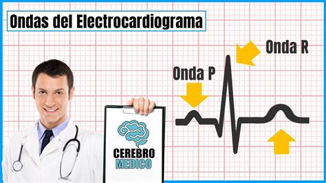 Ondas Del Electrocardiograma Como Leer Un Ekg Paso A Paso Youtube