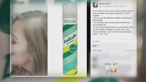 It may be that users of this staple hair care product tend to brush or wash their hair less frequently, leading to the appearance of more hair fall. Experts: Dry Shampoo Overuse May Cause Hair Loss - YouTube