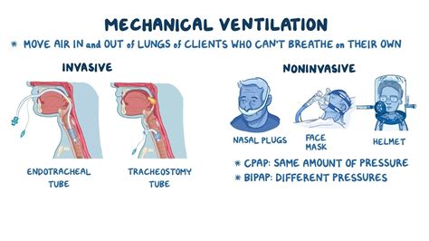 Know About Mechanical Ventilation