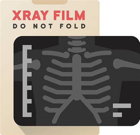 Chest X Ray Illustrations Royalty Free Vector Graphics And Clip Art Istock