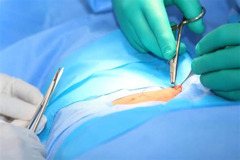 Lumbar Microdiscectomy Surgery Spine Surgeon Mr Mangattil Rajesh