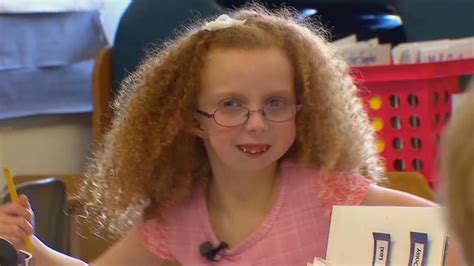 Girl With Rare Condition Born Without Jaw Wtte