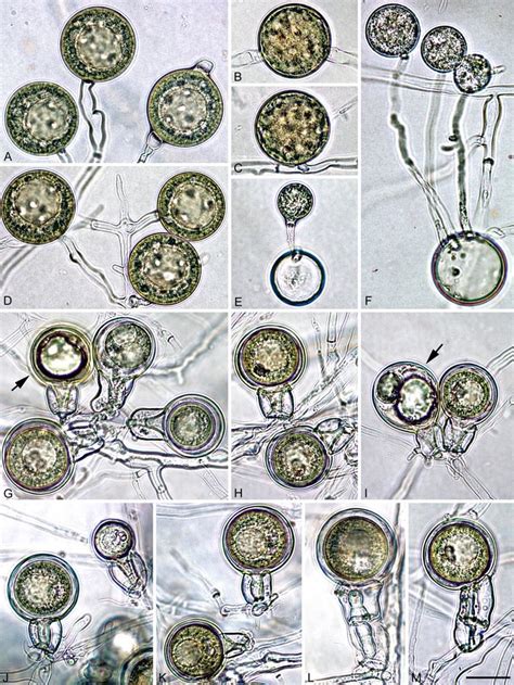 Chlamydospores And Gametangia Of Phytophthora Heterospora A F Thick