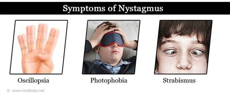 Nystagmus Types Causes Symptoms Diagnosis Treatment And Prevention