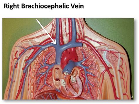 Right Brachiocephalic Vein The Anatomy Of The Veins Visu Flickr