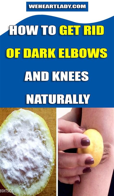How To Get Rid Of Dark Elbows And Knees Naturally Dark Elbows Dark