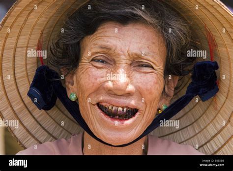 Smiling Vietnamese Woman With Teeth And Lips Stained From Chewing Betel Nut Hoi An Vietnam