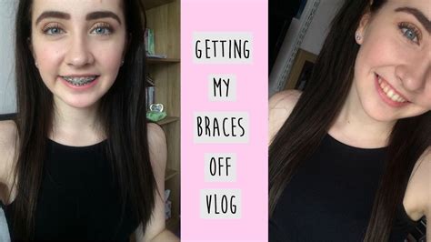 Getting My Braces Off Vlog Veda 13 Jodie Hodgson Youtube