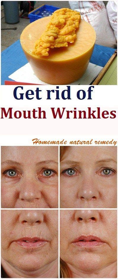 Get Rid Of Wrinkles Naturally Mouth Wrinkles Homemade Wrinkle Cream