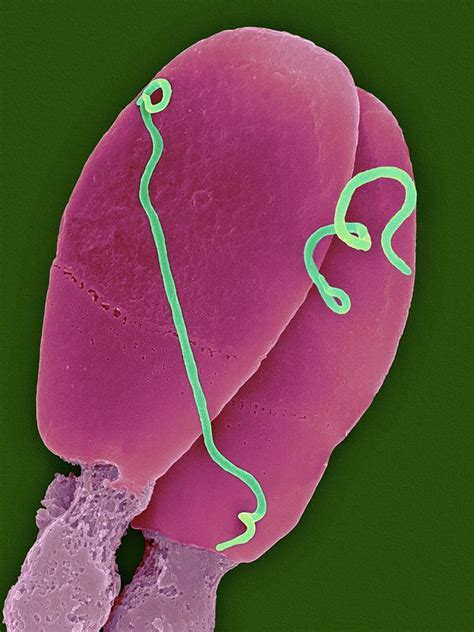 Treponema Pallidum Photograph By Dennis Kunkel Microscopyscience Photo