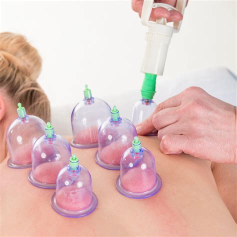 Cupping Strive Pt