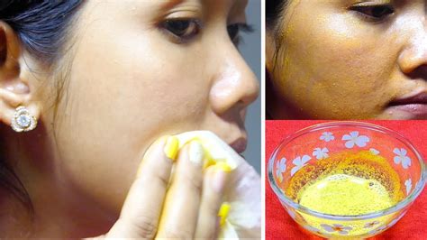 Skin Whitening Turmeric Milk Face Pack For Instant Fair Glowing