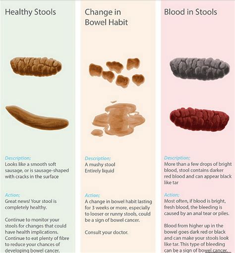 Chart Reveals What Your Poo Says About Your Health Starts At 60