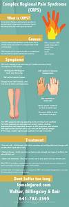 Complex Regional Syndrome Infographic Symptoms And Causes