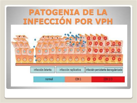 Ppt Infeccion Por Virus De Papiloma Humano Vph Powerpoint Hot Sexiz Pix