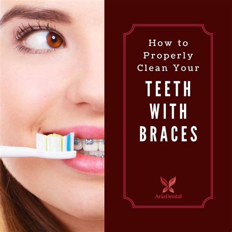 The important thing is, getting your teeth cleaned. How to Properly Clean Your Teeth with Braces