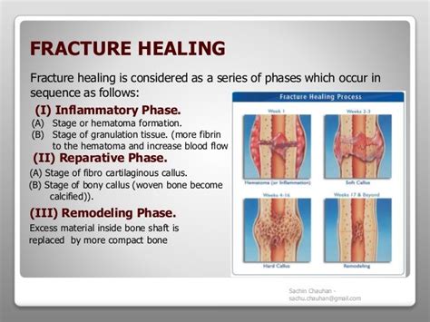 Fracture Types Complications And Management