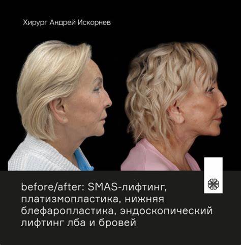 Сколько стоит убрать живот хирургическим путем в тюмени