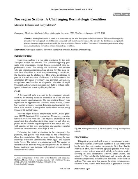 Pdf Norwegian Scabies A Challenging Dermatologic Condition