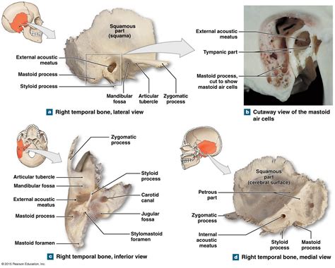 Figure Showing The Temporal Bone Anatomy Bones Biological Anthropology