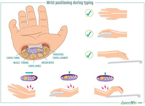 How To Prevent Wrist Pain Sequence Wiz