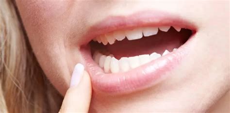 Gum Disease Warning Signs You Shouldnt Ignore
