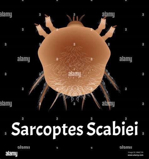 Scabies Mite On Human Skin Stock Vector Images Alamy
