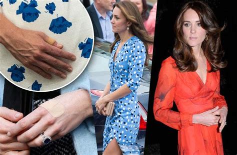 Kate Middleton Bulimia Rumors Princess Sparks Concern Over Photos