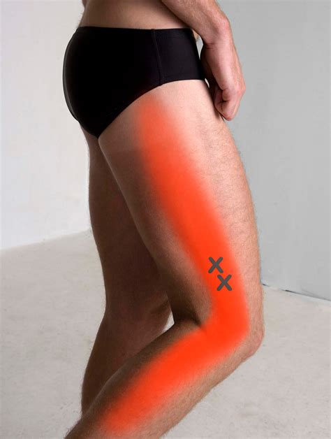About Our Trigger Point Therapy Trigger Point Myotherapy