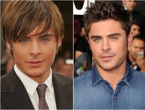 Zac started his career as an actor back in the early 2000's. Zac Efron Plastic Surgery: Nose Job the Curious case of his Rhinoplasty