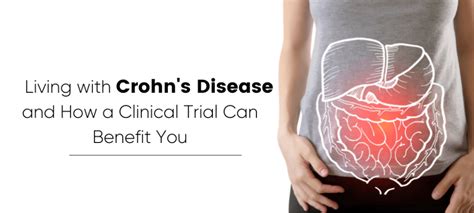 Living With Crohn’s Disease And How A Clinical Trial Can Benefit You