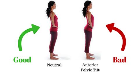 Anterior Pelvic Tilt What It Is And How To Fix It Complete Fitness Design