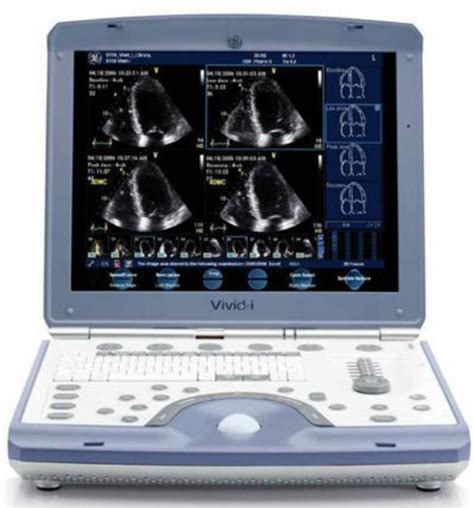 Ge Vivid I Portable Ultrasound Machines For Sale — Integris Equipment Llc