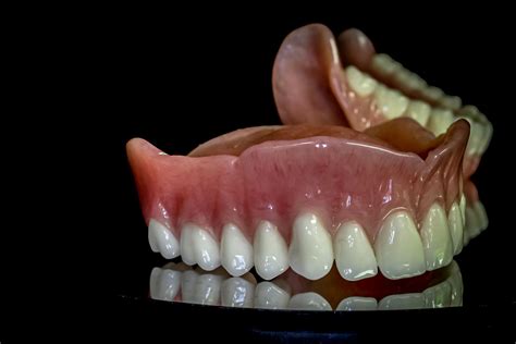 Lower Suction Dentures