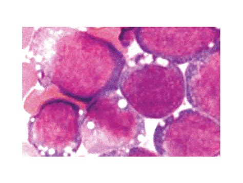 Thrombocyte Histology