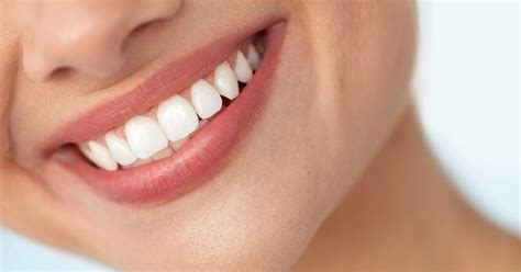 The 101 On Professional Teeth Whitening