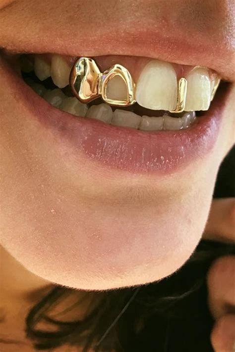 Gold Teeth 2
