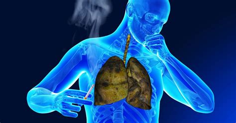 Adoption Of Ngs Reflex Testing For Lung Cancer Efficient Cost