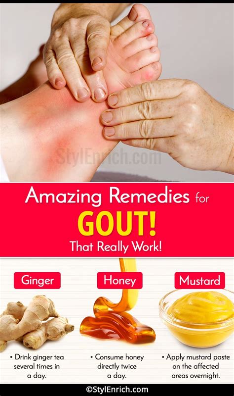Home Remedies For Gout That Really Work And Provide Relief From Pain