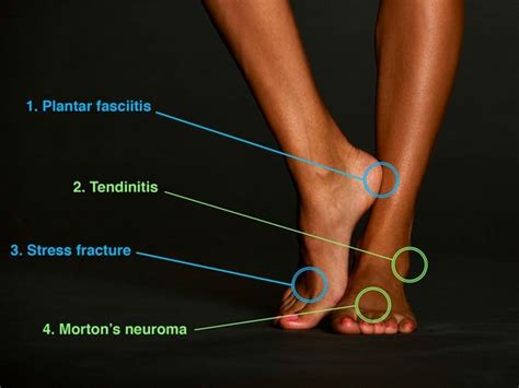4 Foot Injuries To Watch Out For While Running Runners World