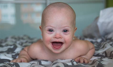 This extra chromosome results in small stature and low muscle tone, among other characteristics. How to Get IHSS for Your Child with Down Syndrome ...