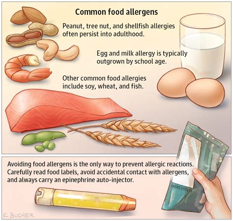 Background, symptoms, diagnosis and treatment options. Treatments for Food Allergies JAMA. 2017;318(19):1945. doi ...