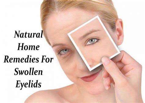 How To Get Rid Of Eyelid Dermatitis In Few Days Yummylooks