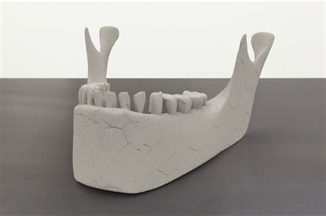 Human Jaw Solidworks 3d Cad Model Grabcad
